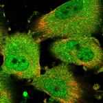 CHML Polyclonal Antibody