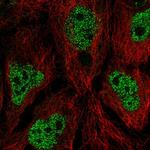 AIM1L Polyclonal Antibody