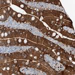 ANKRD34A Antibody in Immunohistochemistry (Paraffin) (IHC (P))