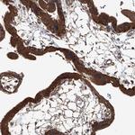 ANKRD34A Antibody in Immunohistochemistry (Paraffin) (IHC (P))
