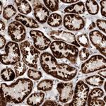 C17orf99 Antibody in Immunohistochemistry (Paraffin) (IHC (P))