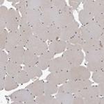 C17orf99 Antibody in Immunohistochemistry (Paraffin) (IHC (P))