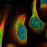 MDN1 Polyclonal Antibody