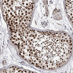 MDN1 Antibody in Immunohistochemistry (Paraffin) (IHC (P))