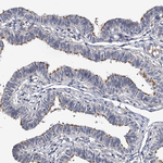 MDN1 Antibody in Immunohistochemistry (Paraffin) (IHC (P))