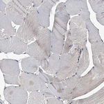 MDN1 Antibody in Immunohistochemistry (Paraffin) (IHC (P))