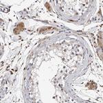 RCL Polyclonal Antibody