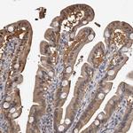 RCL Antibody in Immunohistochemistry (IHC)