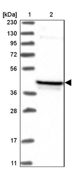 PDSS2 Antibody in Western Blot (WB)