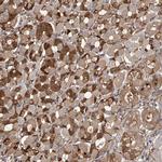 PDSS2 Antibody in Immunohistochemistry (IHC)