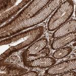 ZNF660 Polyclonal Antibody