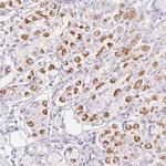 KCNE2 Polyclonal Antibody