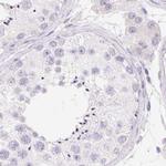 KCNE2 Antibody in Immunohistochemistry (IHC)