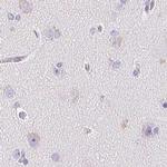 KCNE2 Antibody in Immunohistochemistry (IHC)