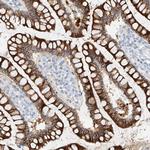 MAP7 Polyclonal Antibody