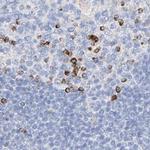 MAP7 Antibody in Immunohistochemistry (IHC)