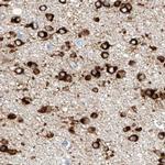 MAP7 Antibody in Immunohistochemistry (IHC)