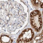 MAP7 Antibody in Immunohistochemistry (IHC)