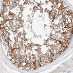 MAP7 Antibody in Immunohistochemistry (IHC)