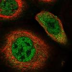 RAD23B Polyclonal Antibody