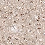 BCL2L15 Polyclonal Antibody