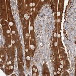 BCL2L15 Antibody in Immunohistochemistry (Paraffin) (IHC (P))