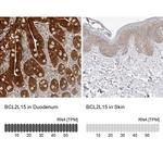 BCL2L15 Antibody in Immunohistochemistry (IHC)