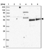 ZNF543 Antibody in Western Blot (WB)