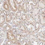 MYOM3 Antibody in Immunohistochemistry (Paraffin) (IHC (P))