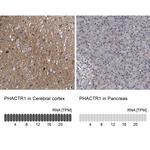PHACTR1 Antibody