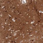 PHACTR1 Polyclonal Antibody