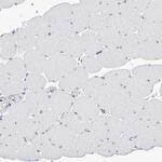 PGM3 Antibody in Immunohistochemistry (IHC)