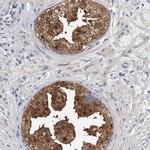 PGM3 Antibody in Immunohistochemistry (IHC)