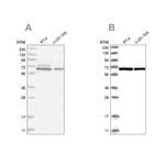 PGM3 Antibody in Western Blot (WB)
