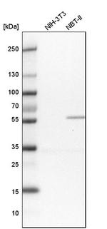PGM3 Antibody in Western Blot (WB)