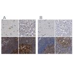 CDV3 Antibody in Immunohistochemistry (IHC)