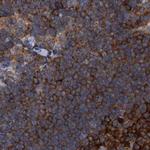 CDV3 Antibody in Immunohistochemistry (IHC)