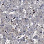 CDV3 Antibody in Immunohistochemistry (IHC)