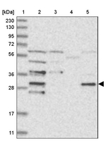 CDV3 Antibody in Western Blot (WB)