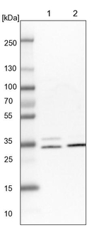 CDV3 Antibody in Western Blot (WB)