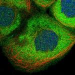 CDV3 Polyclonal Antibody