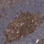 CDV3 Antibody in Immunohistochemistry (Paraffin) (IHC (P))