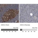 CDV3 Antibody in Immunohistochemistry (IHC)