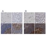 CDV3 Antibody in Immunohistochemistry (IHC)