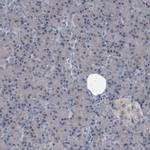 CDV3 Antibody in Immunohistochemistry (IHC)