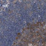 CDV3 Antibody in Immunohistochemistry (IHC)