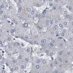 CDV3 Antibody in Immunohistochemistry (IHC)