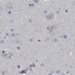 CDV3 Antibody in Immunohistochemistry (IHC)