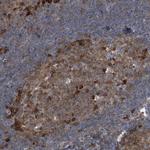 CDV3 Antibody in Immunohistochemistry (Paraffin) (IHC (P))