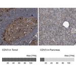 CDV3 Antibody in Immunohistochemistry (IHC)